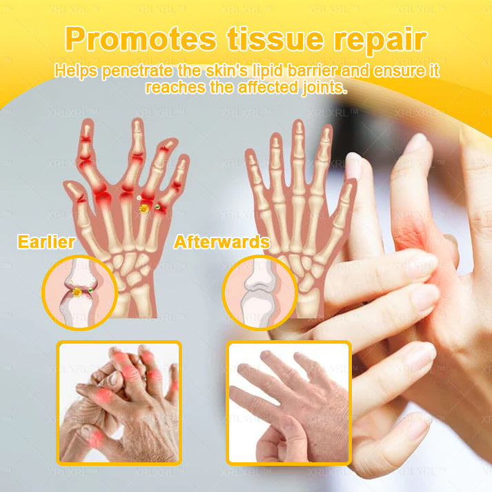 Purelora®💞💞 Bee Venom Pain-Relief Bone Healing Cream  (Specially for older adults)