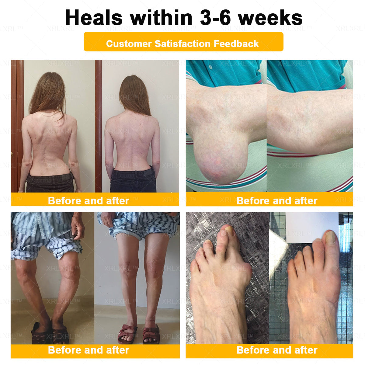 Purelora®💞💞 Bee Venom Pain-Relief Bone Healing Cream  (Specially for older adults)