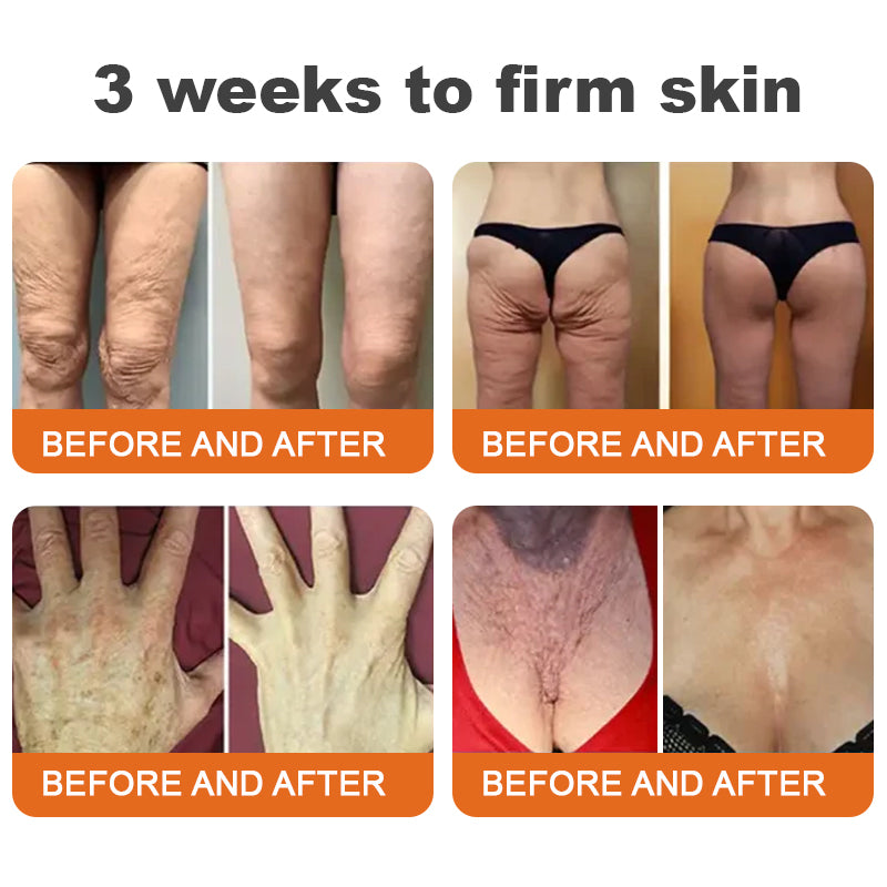"Hecho y enviado desde Estados Unidos | 🐝 Tienda oficial ✨ Crema reparadora para la piel con veneno de abeja Purelora® 🔥 ÚLTIMO DÍA 80% DE DESCUENTO 💎"