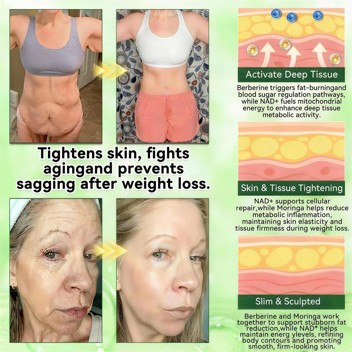 𝑶𝒇𝒇𝒊𝒄𝒊𝒂𝒍 𝒔𝒕𝒐𝒓𝒆  | Curalona®❤️ 𝐌𝐨𝐫𝐢𝐧𝒈𝗮 𝑩𝒆𝒓𝒃𝒆𝐫𝐢𝐧𝐞𝐱 𝐍𝗔𝒟+ 10-𝑖n-1 𝐍a𝒏𝒐 𝐌𝐢𝐜𝐫𝑜𝑛𝑒𝑒𝗱𝗹𝗲 𝐏𝐚𝒕𝒄𝒉(𝐉𝐮𝐬𝐭 𝐨𝐧𝐜𝐞 𝐚 𝐝𝐚𝐲, 𝐯𝐢𝐬𝐢𝐛𝐥𝐞 𝐜𝐡𝐚𝐧𝐠𝐞𝐬 𝐢𝐧 𝟕 𝑫𝐚𝐲𝐬） 𝐅𝐨𝐫 𝐎𝐛𝐞𝐬𝐢𝐭𝐲,  𝙇𝙊𝙊𝙎𝗘 𝗦𝗞𝗜𝗡, 𝐬𝐥𝐞𝐞𝐏 𝐚𝐩𝐧𝐞𝐚, 𝐣𝐨𝐢𝐧𝐭 𝐢𝐬𝐬𝐮𝙚𝙨, 𝐚𝐧𝐝 𝐦𝐨𝐫𝐞 ⚡