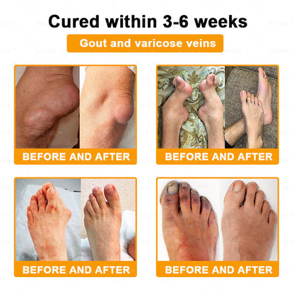 Purelora®💞💞 Bee Venom Pain-Relief Bone Healing Cream  (Specially for older adults)