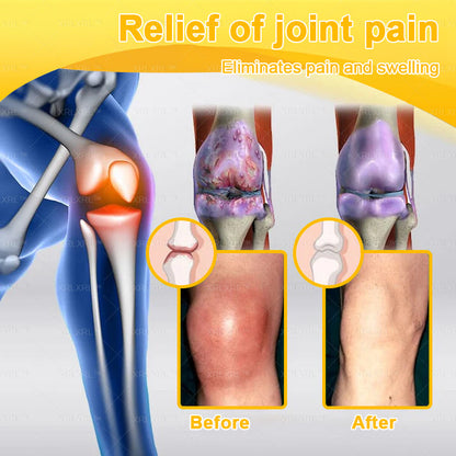 Purelora®💞💞 Bee Venom Pain-Relief Bone Healing Cream  (Specially for older adults)